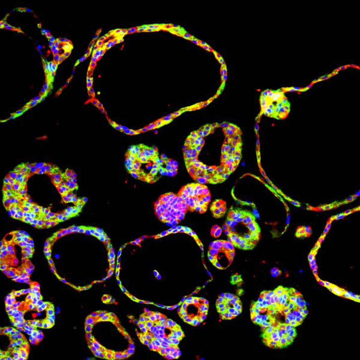 Miniorgan, Modell aus pluripotenten Stammzellen entwickelt, für Bauchspeicheldrüse. 